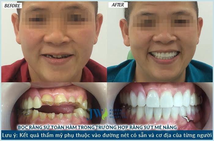 benh vien tham my JW anh 5