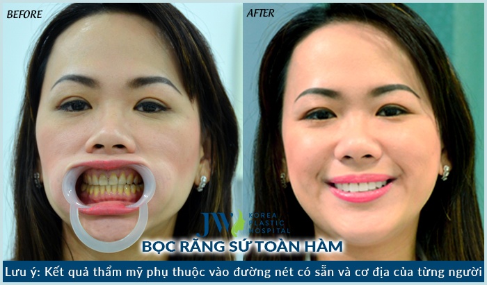 benh vien tham my JW anh 6