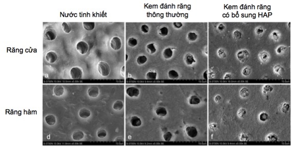 P/S Sensitive Expert ảnh 5 P/S Sensitive Expert anh 5