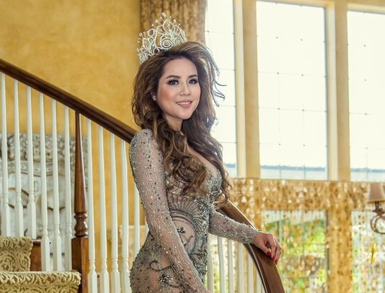 Hoa hau nguoi Viet the gioi khoe nhan sac sau phau thuat tham my hinh anh