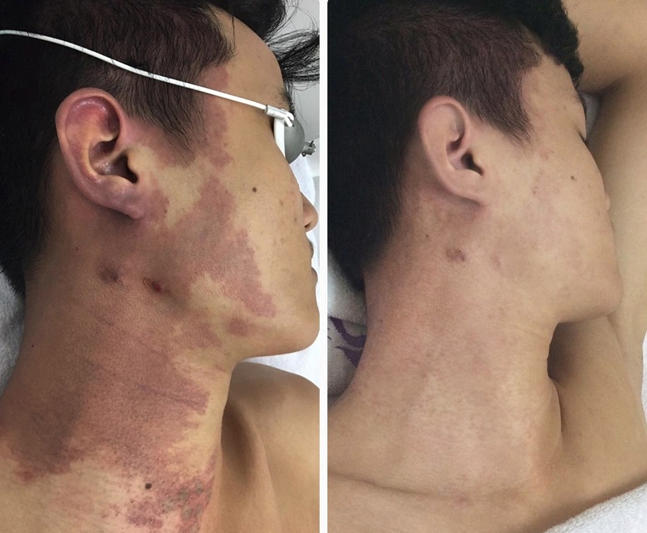 thẩm mỹ Hoàng Tuấn ảnh 5 tham my Hoang Tuan anh 5