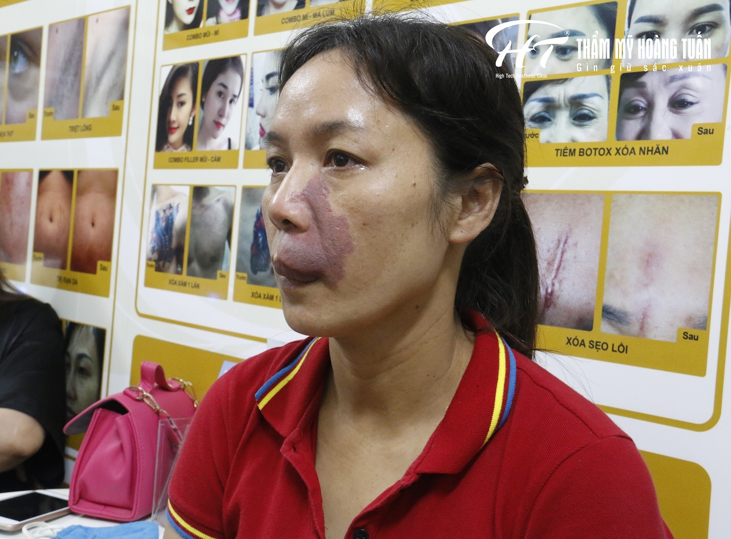 thẩm mỹ Hoàng Tuấn ảnh 4 tham my Hoang Tuan anh 4