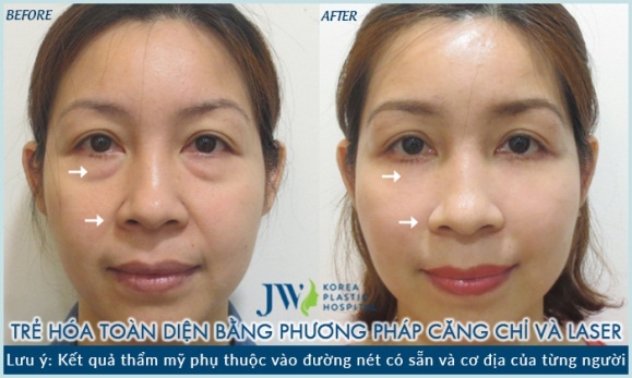 JW Skincare ảnh 2 JW Skincare anh 2