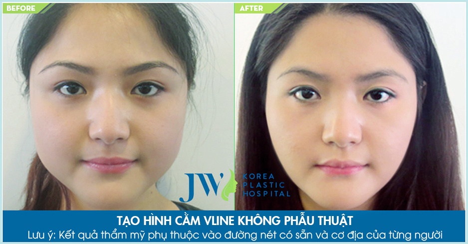JW Skincare ảnh 3 JW Skincare anh 3