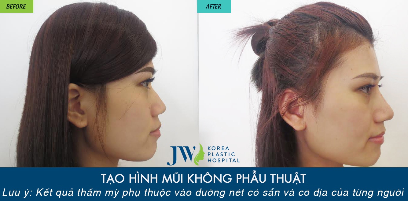 JW Skincare ảnh 4 JW Skincare anh 4