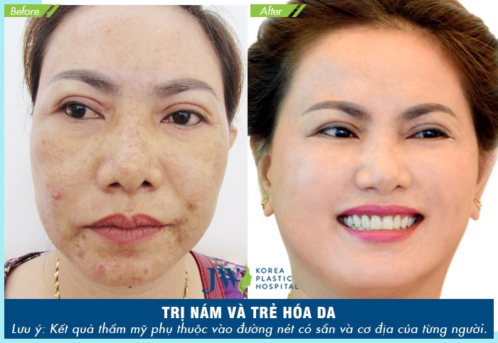 JW Skincare ảnh 5 JW Skincare anh 5