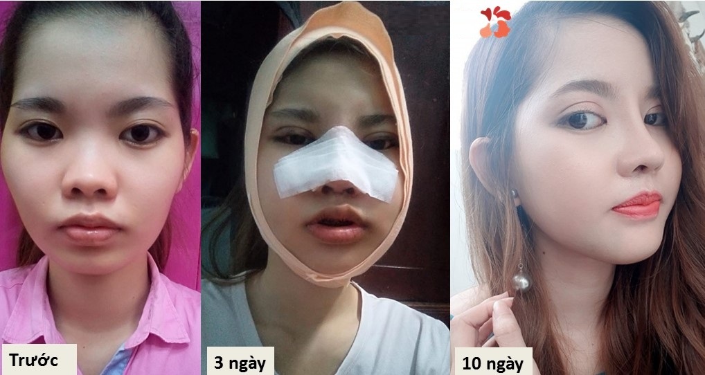 benh vien tham my Kangnam anh 2