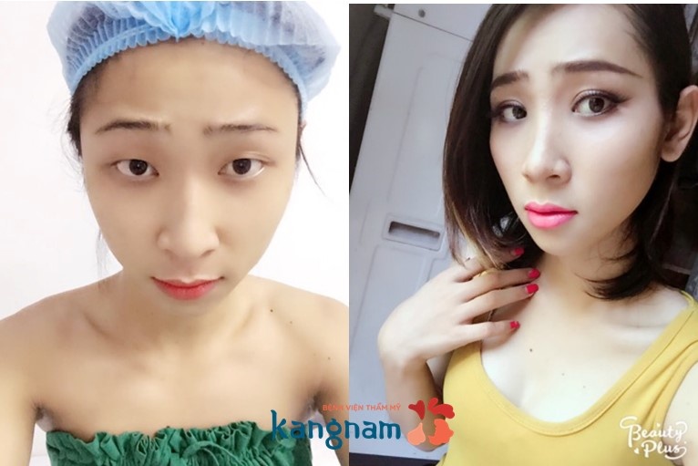 benh vien tham my Kangnam anh 3