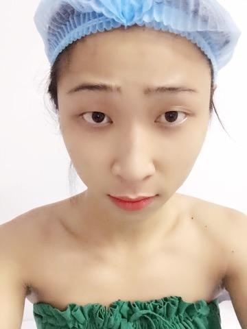 Bệnh viện Thẩm mỹ Kangnam ảnh 3 Benh vien Tham my Kangnam anh 3