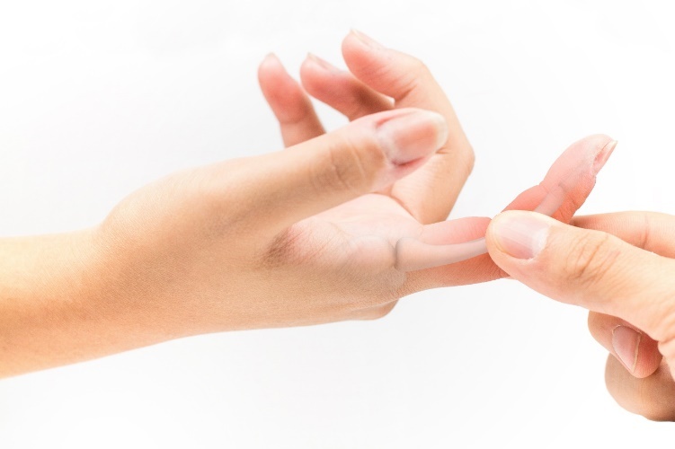 triệu chứng đau cứng khớp ngón tay buổi sáng ảnh 1 trieu chung dau cung khop ngon tay buoi sang anh 1