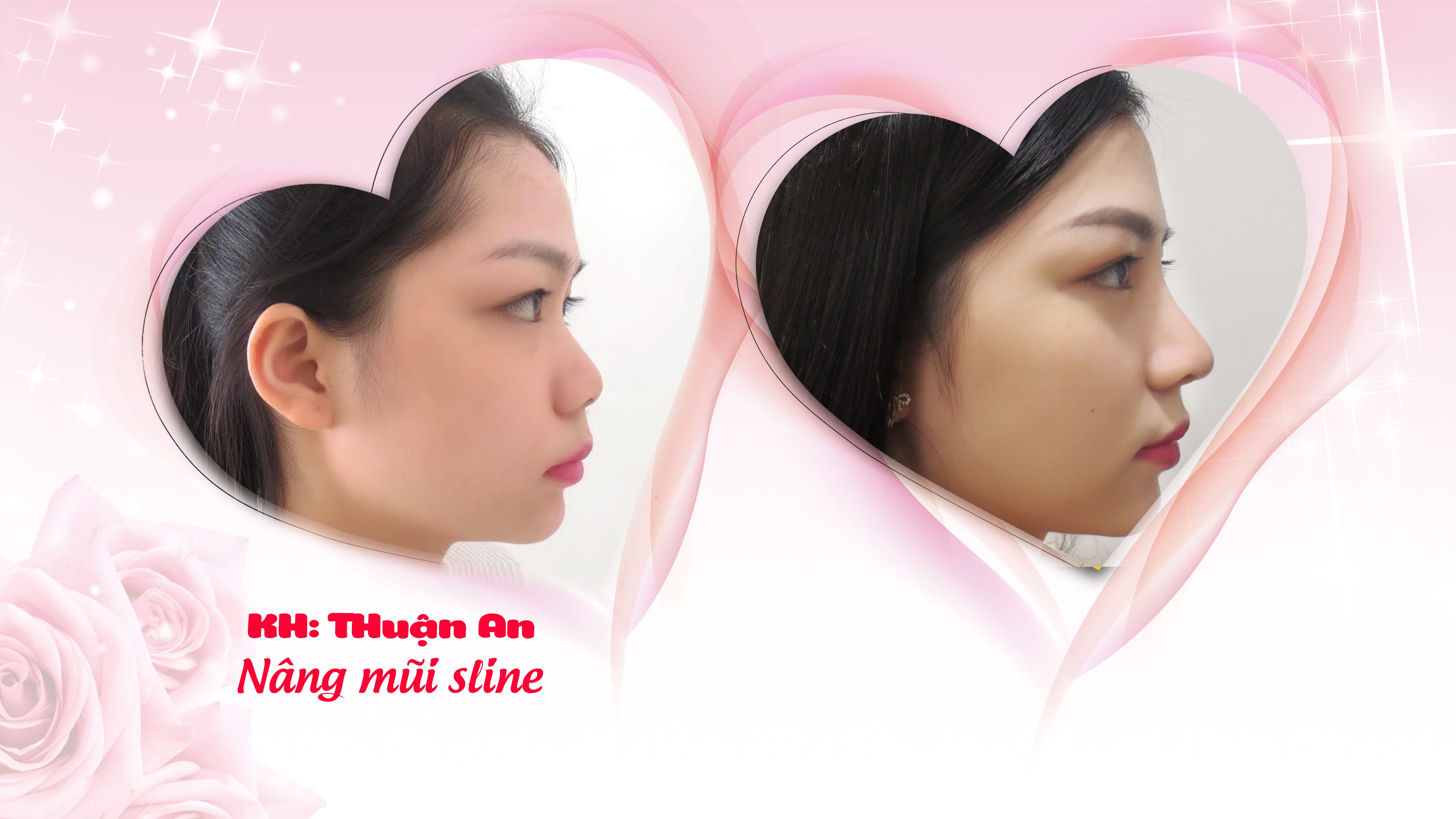 Benh vien Tham my JW Han Quoc anh 1