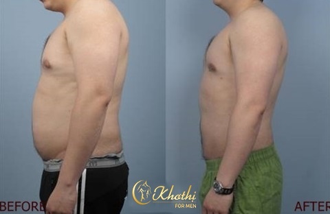 Spa Khơ Thị ảnh 3 Spa Kho Thi anh 3