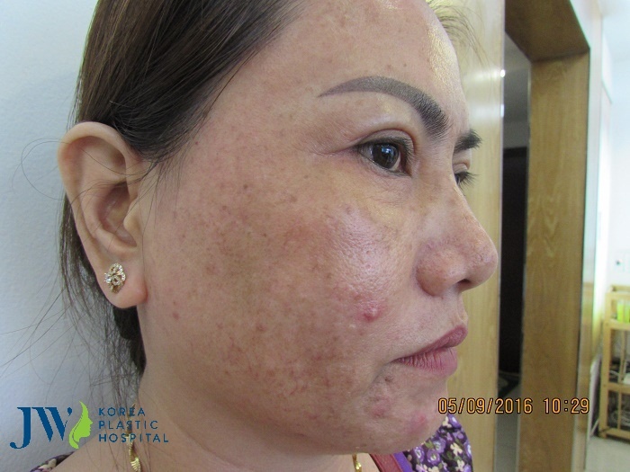 VIP Beauty Center JW  ảnh 1 VIP Beauty Center JW anh 1