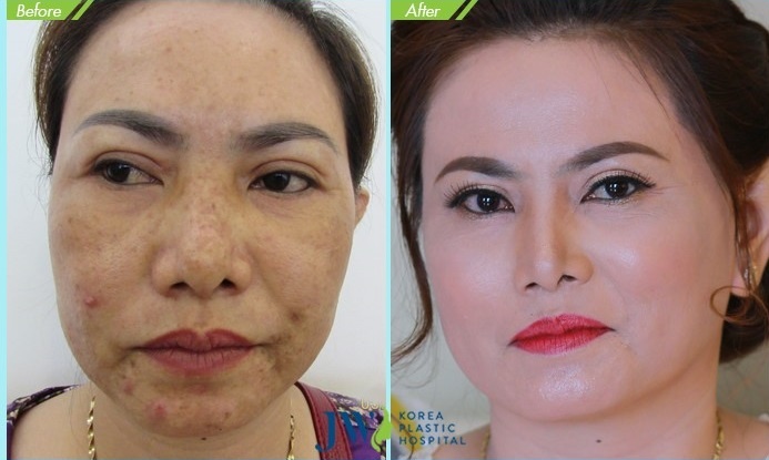 VIP Beauty Center JW  ảnh 2 VIP Beauty Center JW anh 2