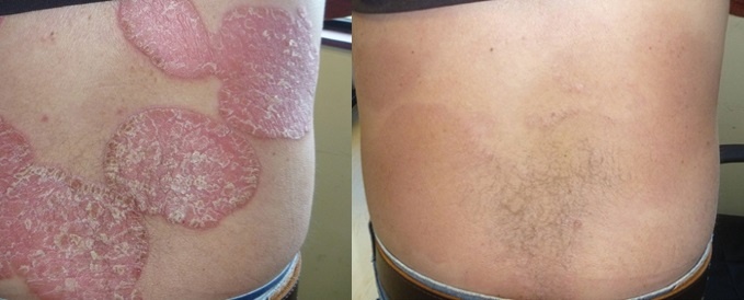 Dr. Michaels ảnh 2 Dr. Michaels anh 2