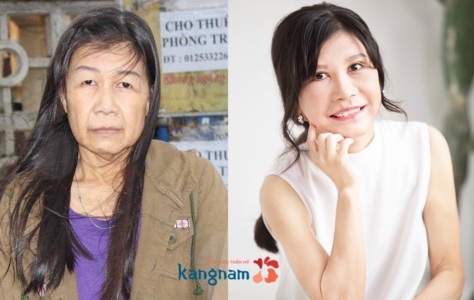 Hành trình lột xác 2017  ảnh 4 Hanh trinh lot xac 2017 anh 4