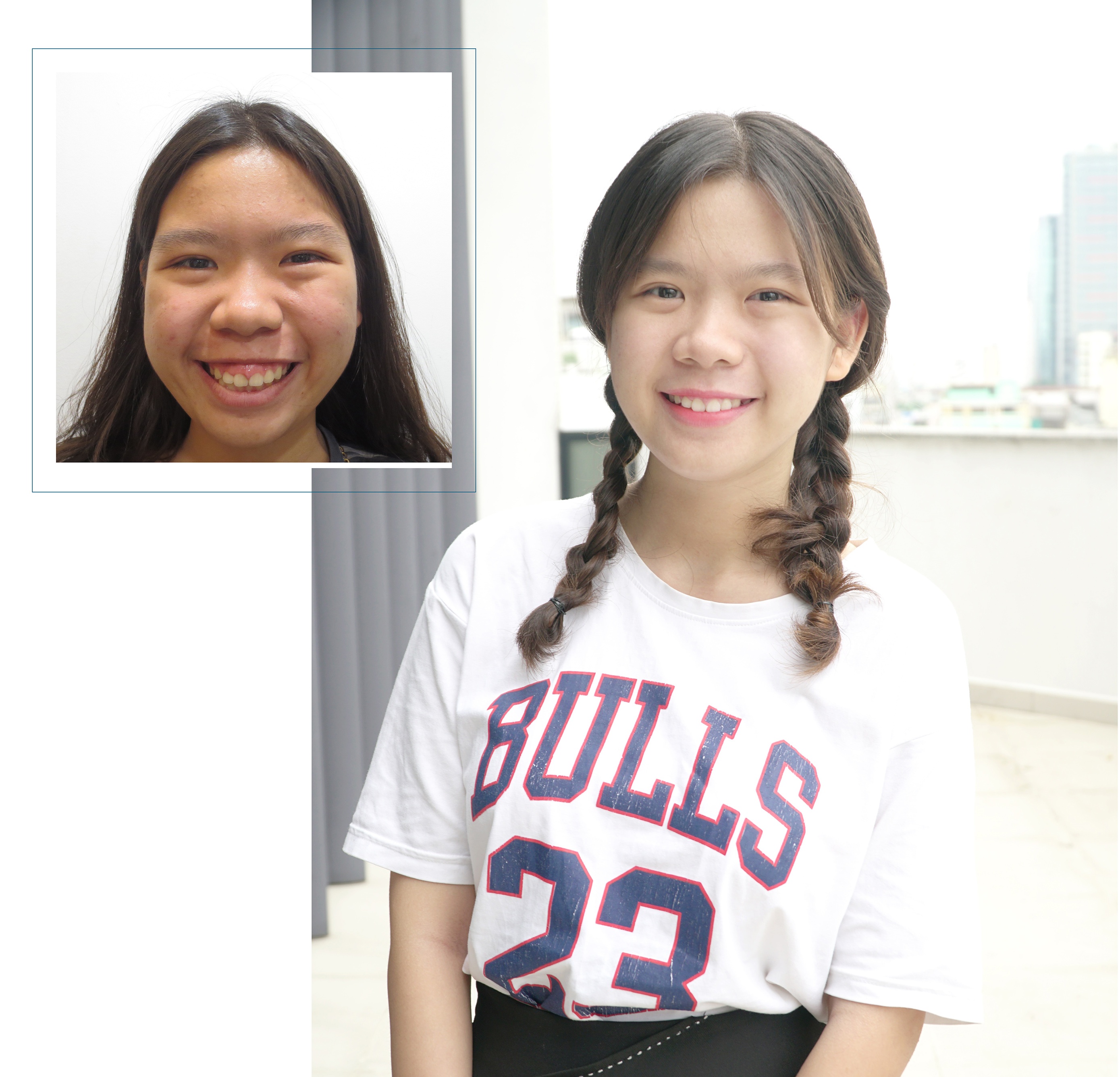 bệnh viện thẩm mỹ JW Hàn Quốc ảnh 3 benh vien tham my JW Han Quoc anh 3