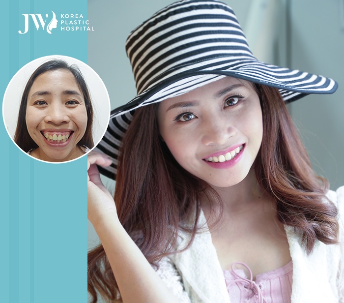 bệnh viện thẩm mỹ JW Hàn Quốc ảnh 2 benh vien tham my JW Han Quoc anh 2