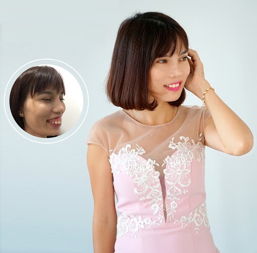 bệnh viện thẩm mỹ JW Hàn Quốc ảnh 5 benh vien tham my JW Han Quoc anh 5