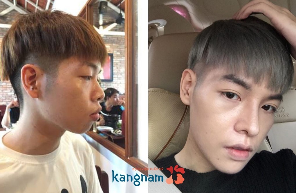 Bệnh viện Thẩm mỹ Kangnam ảnh 2 Benh vien Tham my Kangnam anh 2