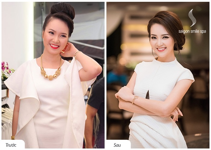 Spa ảnh 1 Spa anh 1