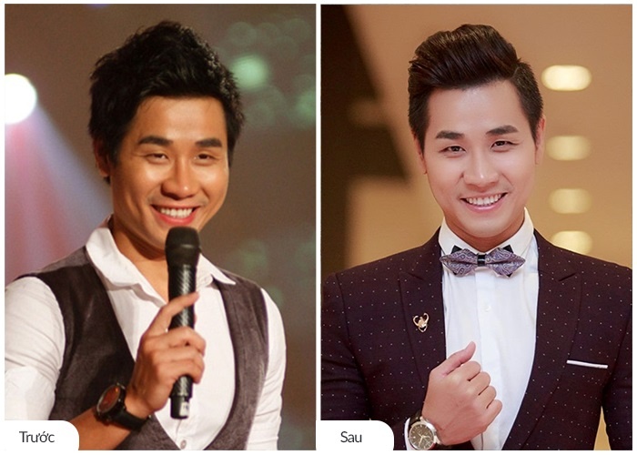 Nhan sac nguoi noi tieng truoc va sau khi 'tan trang' hinh anh