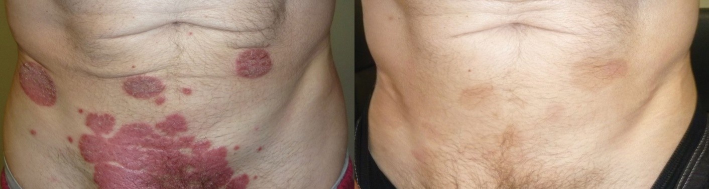 Dr. Michaels ảnh 2 Dr. Michaels anh 2