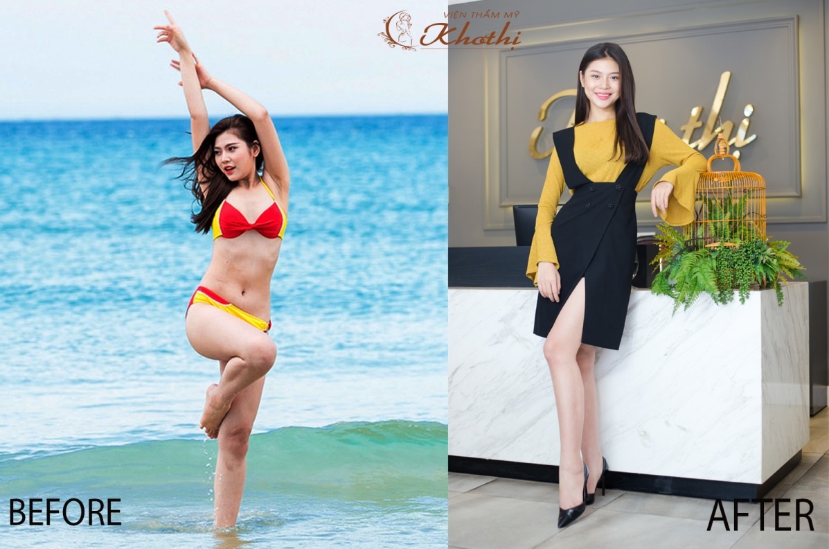 Vien Tham my Kho Thi anh 3