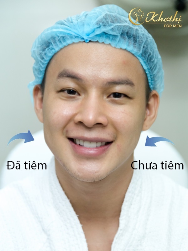 Vien tham my Kho Thi anh 3