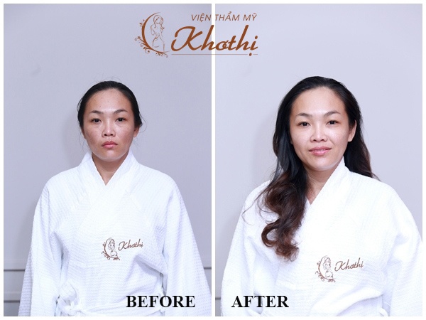 Vien tham my Kho Thi anh 2