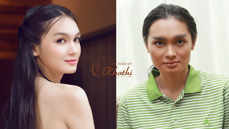 Vien tham my Kho Thi anh 5