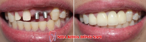 Nha khoa Đông Nam ảnh 4 Nha khoa Dong Nam anh 4