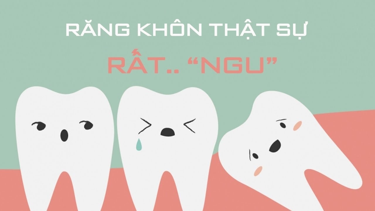 nhổ răng khôn không đau bằng phương pháp mới ảnh 1 nho rang khon khong dau bang phuong phap moi anh 1