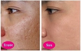 Doctor Kiệm Spa ảnh 2 Doctor Kiem Spa anh 2