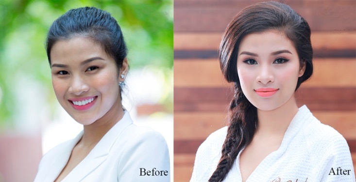 Sao Viet 'lot xac' bat ngo sau tham my hinh anh