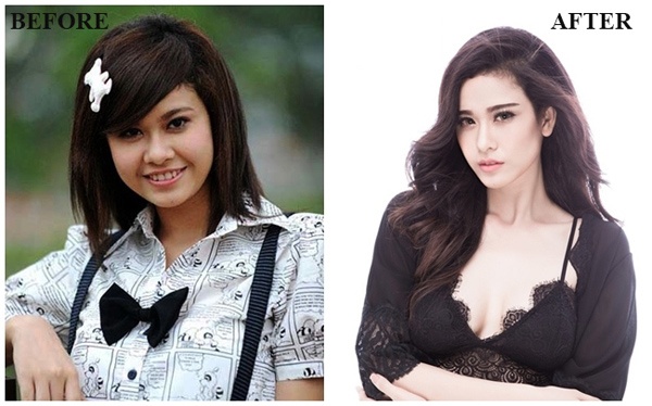 Tham my Kho Thi anh 4