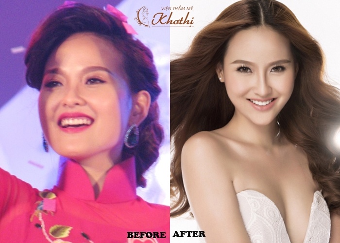 Tham my Kho Thi anh 6