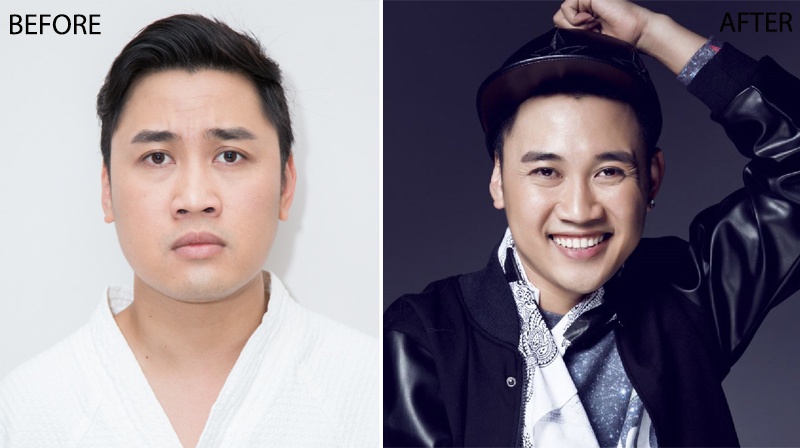 Tham my Kho Thi anh 7