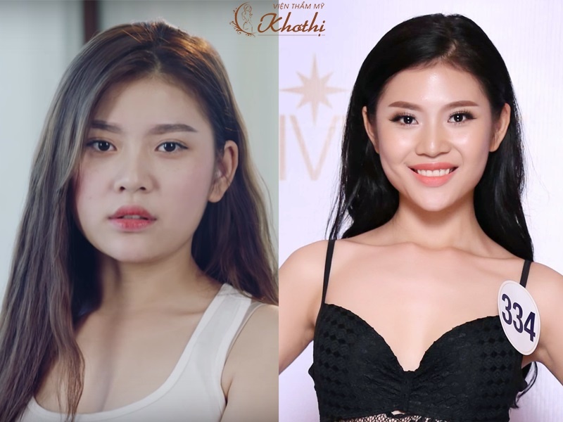 vien tham my Kho Thi anh 1