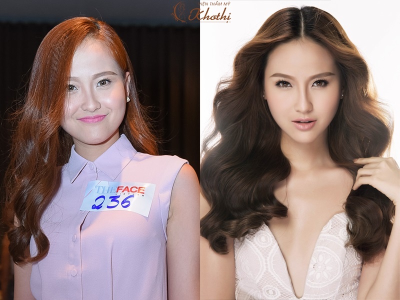 vien tham my Kho Thi anh 2