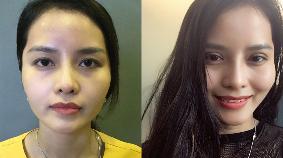 Viện Thẩm mỹ Y khoa Dr.Hải Lê ảnh 1 Vien Tham my Y khoa Dr.Hai Le anh 1