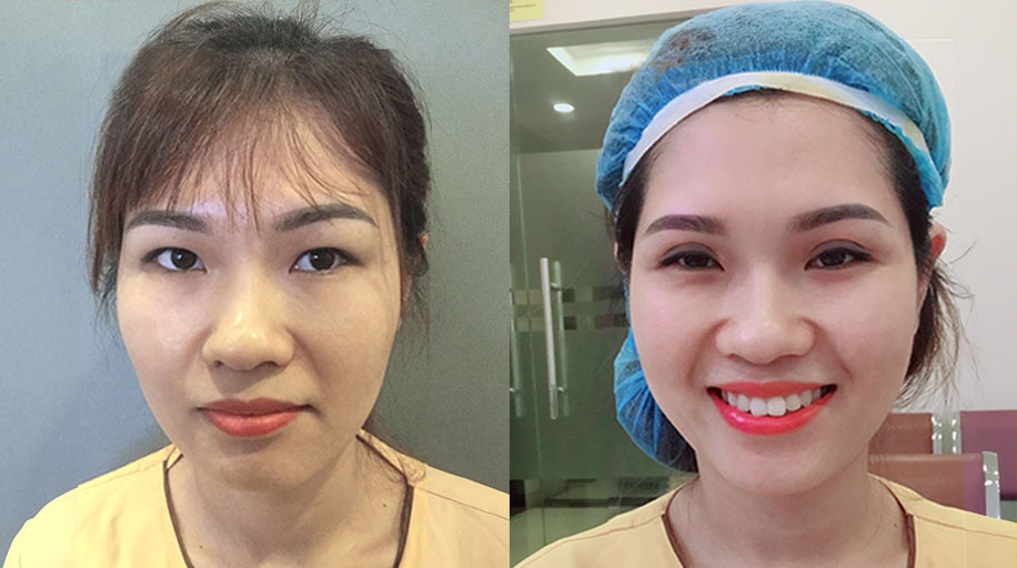 Viện Thẩm mỹ Y khoa Dr.Hải Lê ảnh 3 Vien Tham my Y khoa Dr.Hai Le anh 3