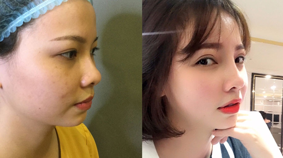 Viện thẩm mỹ Y Khoa Dr.Hải Lê ảnh 2 Vien tham my Y Khoa Dr.Hai Le anh 2