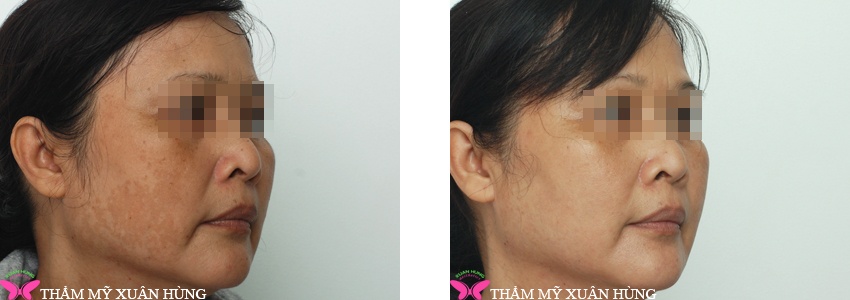 tham my vien xuan hung anh 3