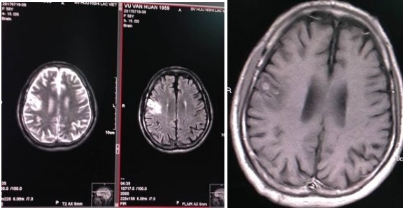 Benh vien Huu Nghi Lac Viet anh 5