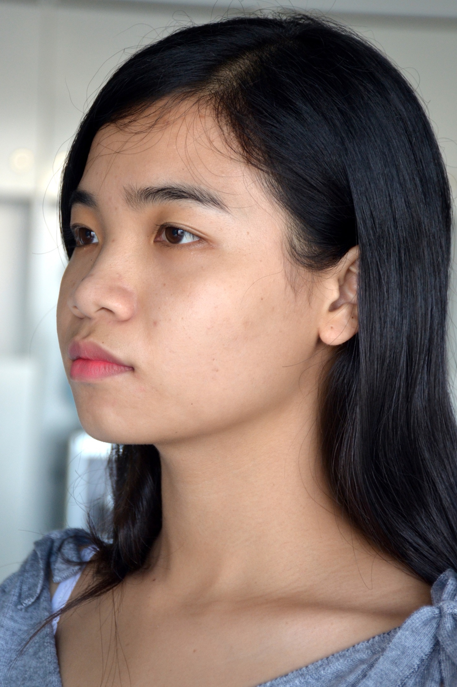 Bệnh viện Thẩm mỹ JW ảnh 2 Benh vien Tham my JW anh 2