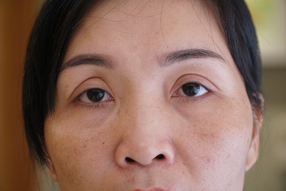 Bệnh viện thẩm mỹ JW ảnh 2 Benh vien tham my JW anh 2