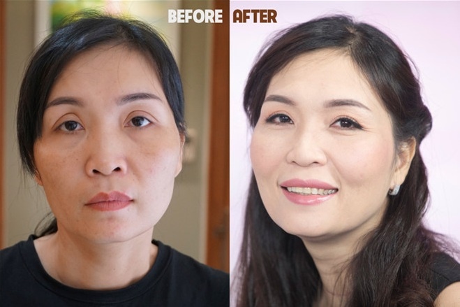 Bệnh viện thẩm mỹ JW ảnh 1 Benh vien tham my JW anh 1