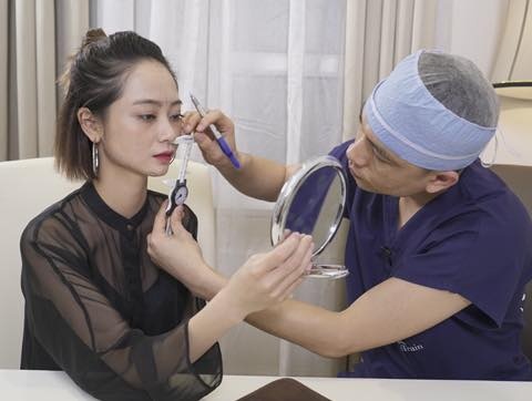 Nhung dieu can biet ve phau thuat tham my xuong mat hinh anh