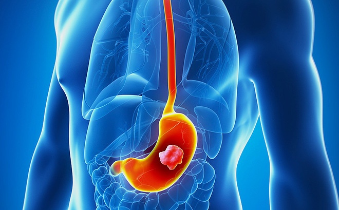 Fucoidan3 - plus anh 4